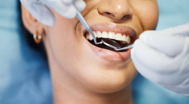 Best Emergency Dentist for Lost Fillings or Crowns in Heeia, HI